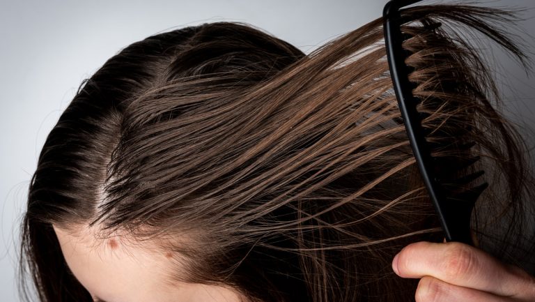 Przetłuszczające się włosy – sprawdzone sposoby
